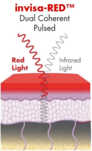 Invisa-Red